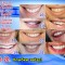 db2-p19vvurhtd5d8l9sl1bvd157tk.jpg