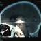 cb7-p1a3gljuep1rqst7p1f5mbr4fof6.jpg
