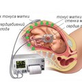 382-p19tu86d9btdg56mb1fdub19m14.jpg