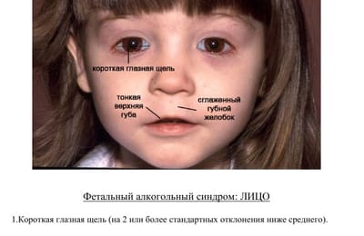 Смотримся в зеркало