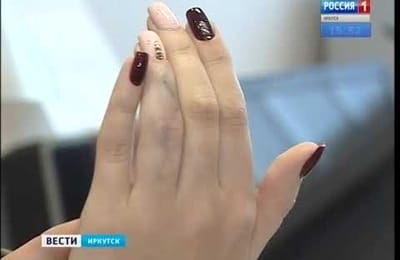 Врачи в Иркутске впервые в мире заменили человеческую кость наноструктурным углеродом