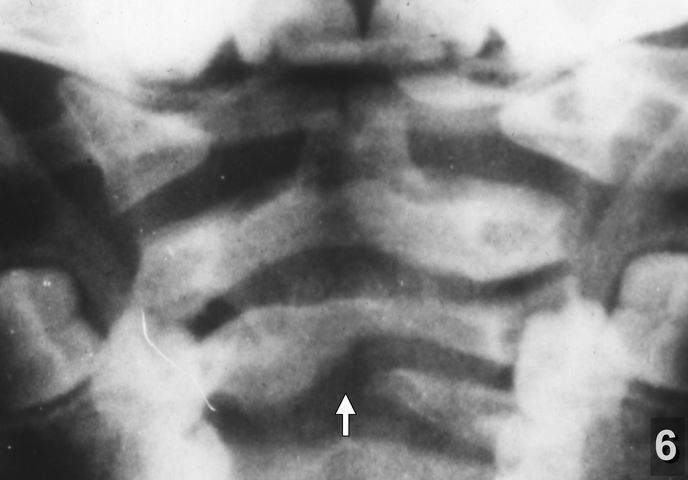 N-6 (206)готово