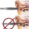 Ear1 Ear1