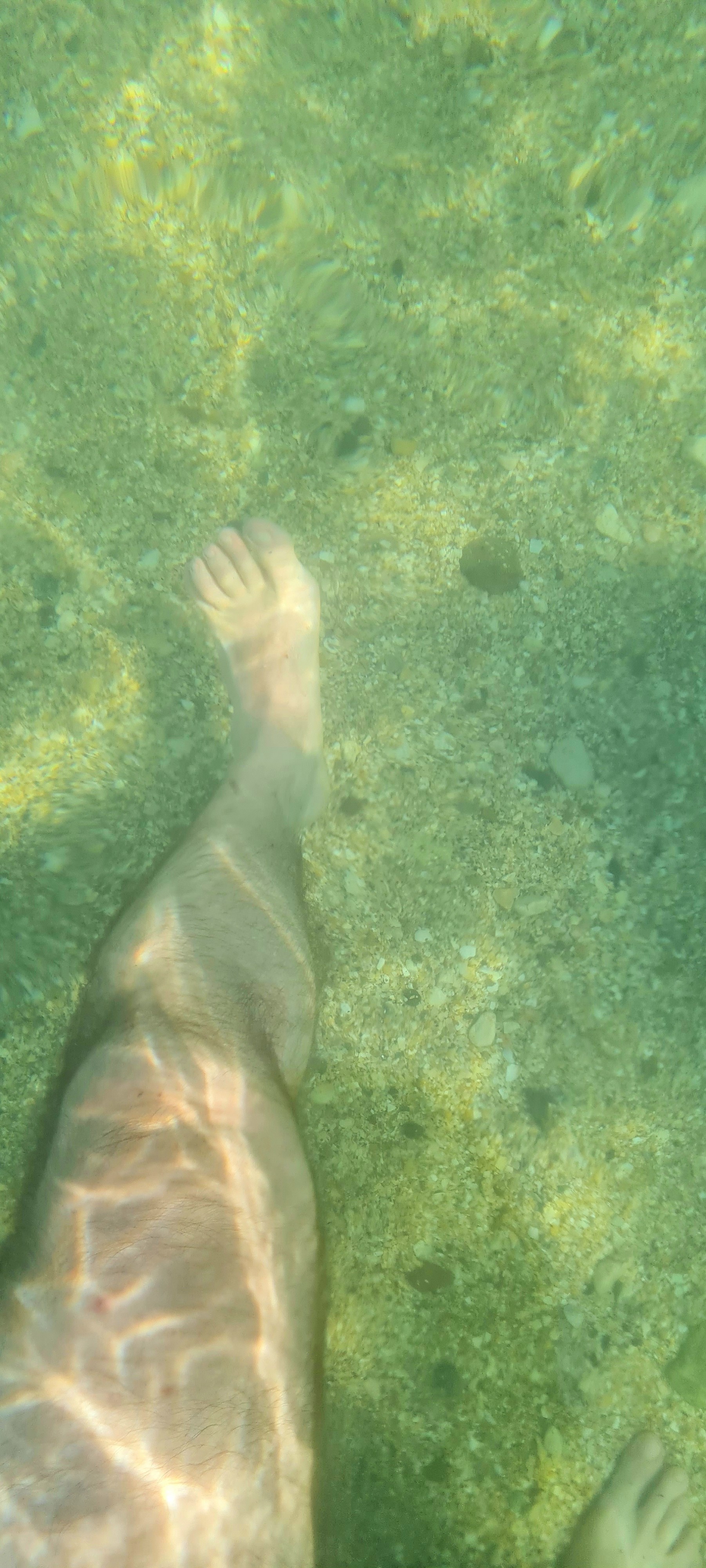 нога сирёгина отдыхающевморесолёномсперском)))))