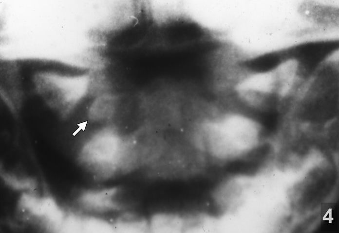 N-4 (214)готово