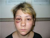 Ищо адна
