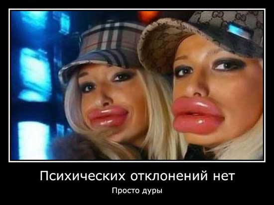 Просто дуры