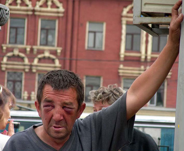 Жертвы геноцида