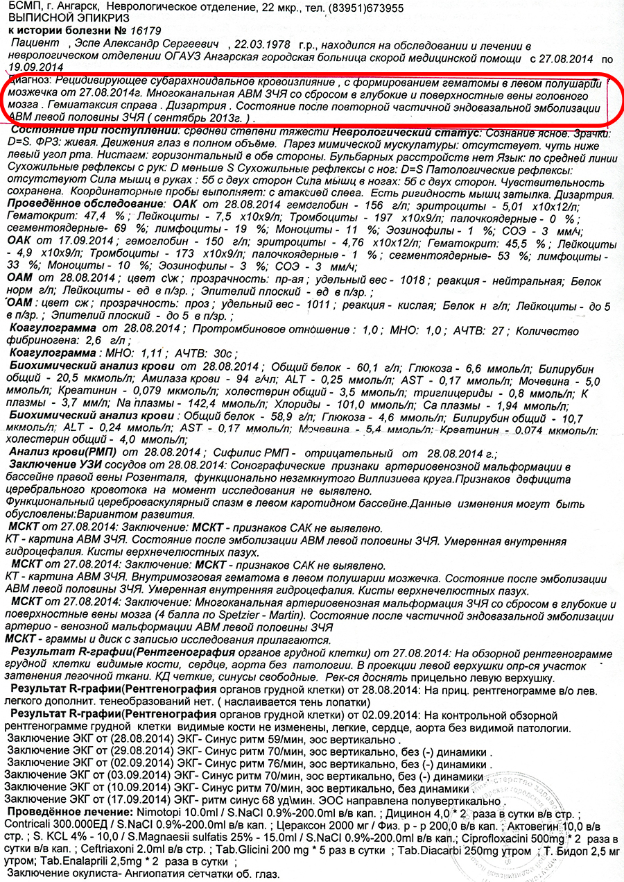 3 инсульт
