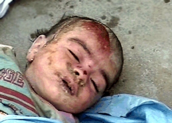 Жертвы натовских бомбежек 