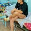 Этому пациенту, гулявшему зимой по улице в легкой обуви, грозит ампутация обеих ног.