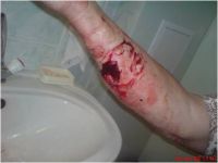 Укус!!!Зомби на наших улицах!!! Укус!!!Зомби на наших улицах!!!